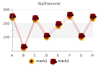 order naltrexone 50 mg line